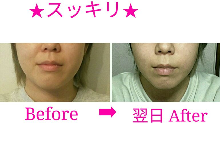 ビフォーアフター写真