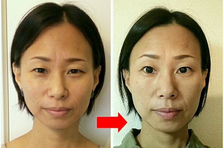ビフォーアフター写真