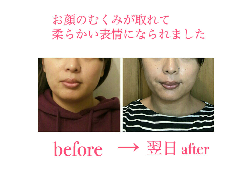 ビフォーアフター写真