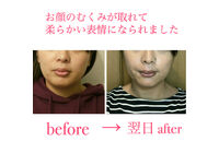 ビフォーアフター写真