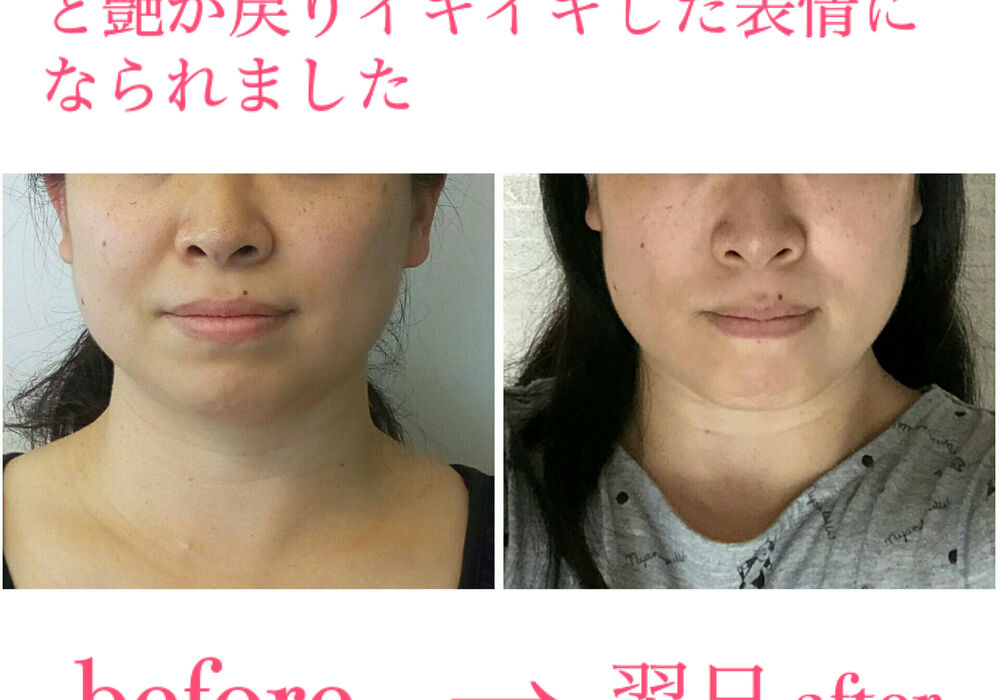 ビフォーアフター写真
