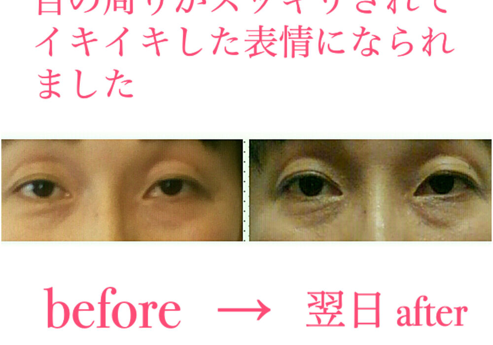 ビフォーアフター写真