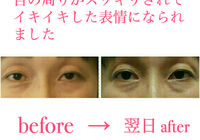 ビフォーアフター写真