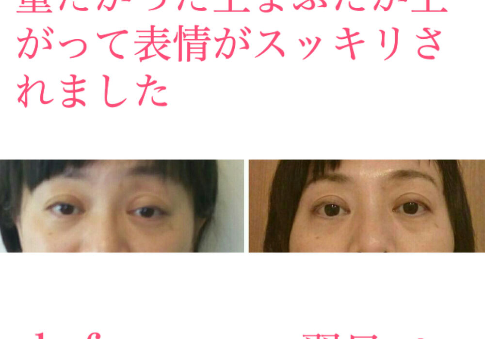 ビフォーアフター写真