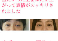 ビフォーアフター写真