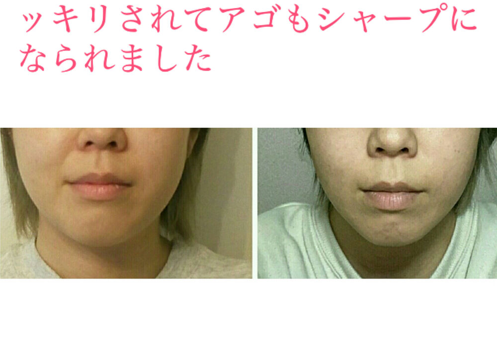 ビフォーアフター写真