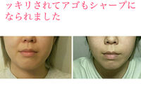 ビフォーアフター写真