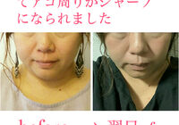 ビフォーアフター写真