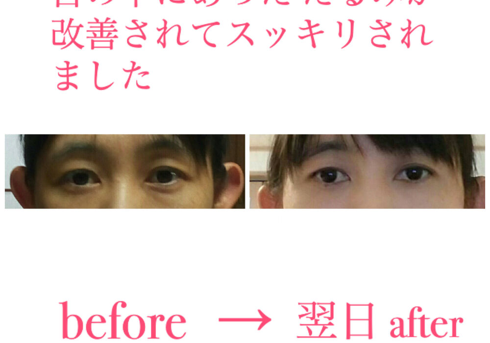 ビフォーアフター写真
