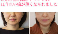 ビフォーアフター写真