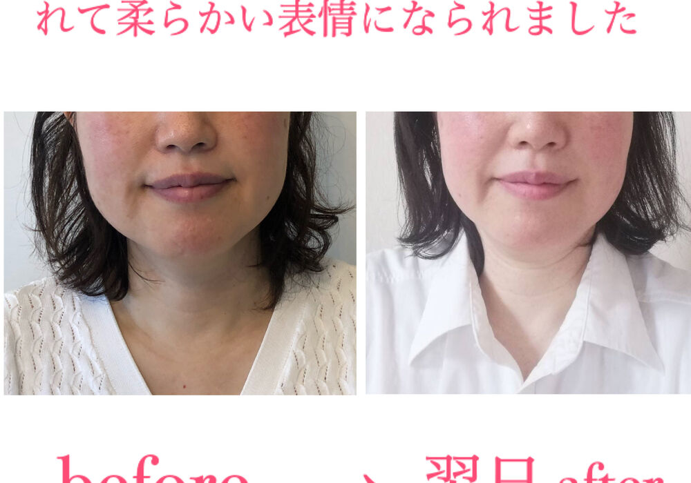 ビフォーアフター写真