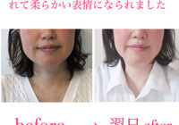 ビフォーアフター写真
