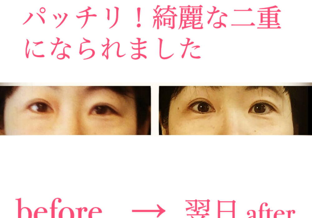 ビフォーアフター写真