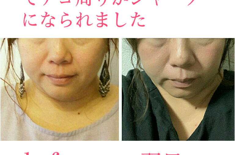 ビフォーアフター写真