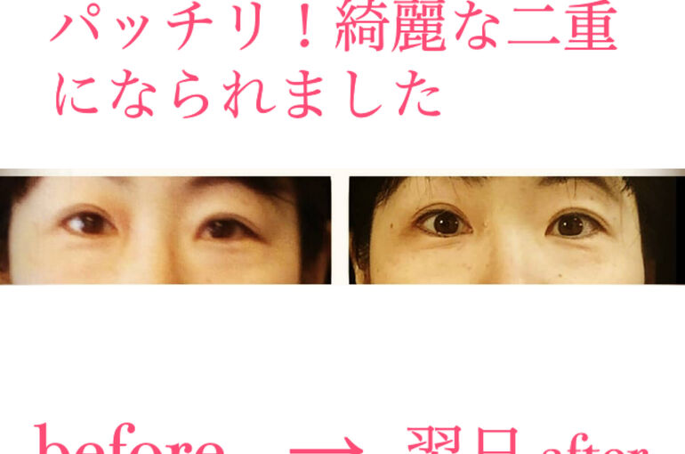 ビフォーアフター写真