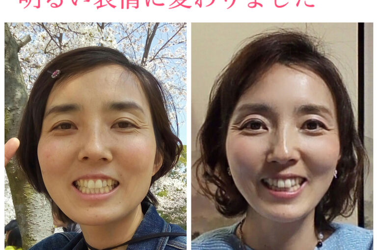 ビフォーアフター写真